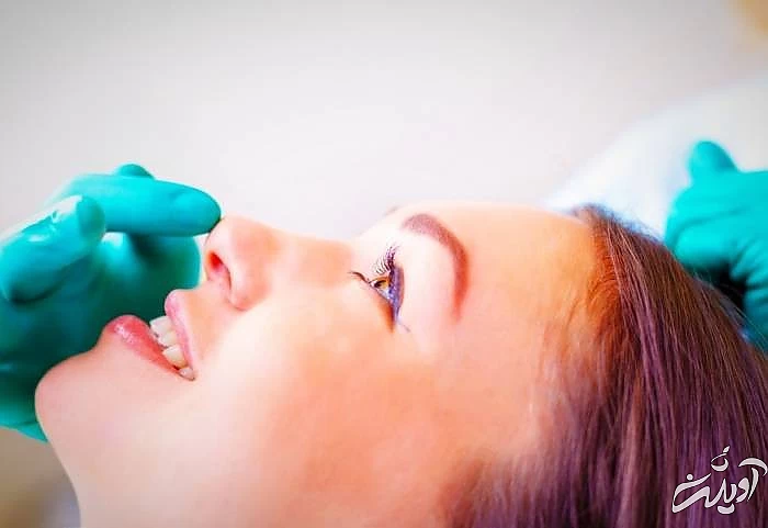 جراحی زیبایی بینی